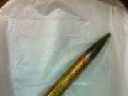 Dangerous hobby: Odessa resident injured while dismantling a shell in his own apartment