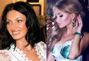 Евгения Феофилактова до и после операции. Фото