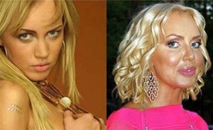 Маша Малиновская до и после пластики. Фото