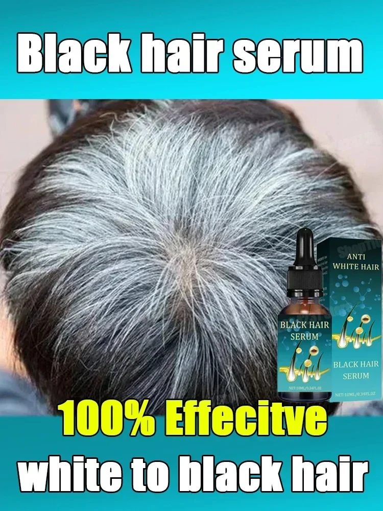 Natural Anti Gray Hair Serum - Repair White & Darkening Hair Nourishing Hair Care Remedy works very good