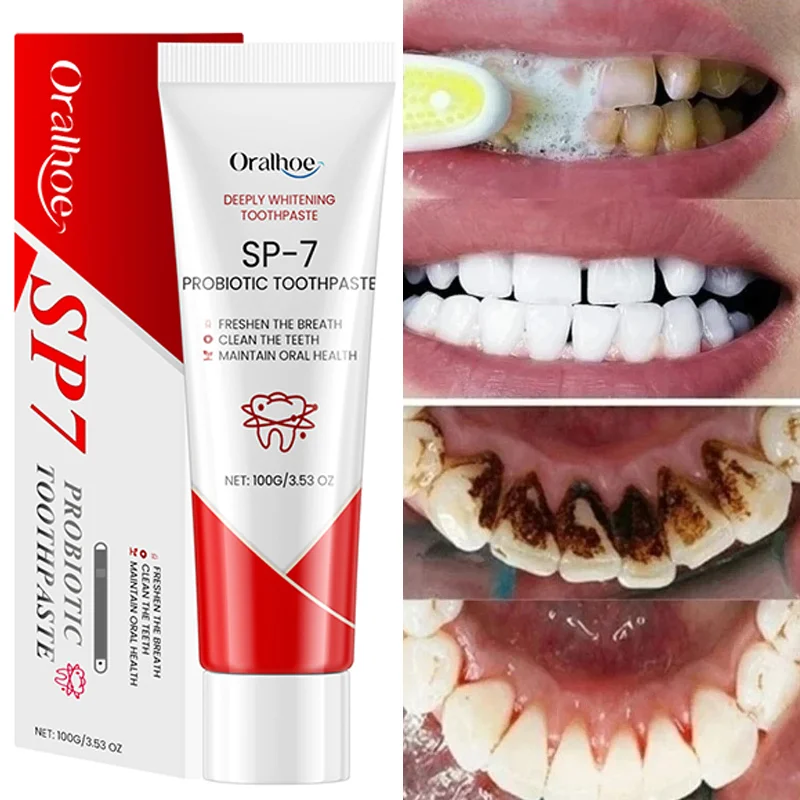 SP-7 Probiotic Toothpaste Whiten Clean Teeth Remove Stains Oral Care Management 