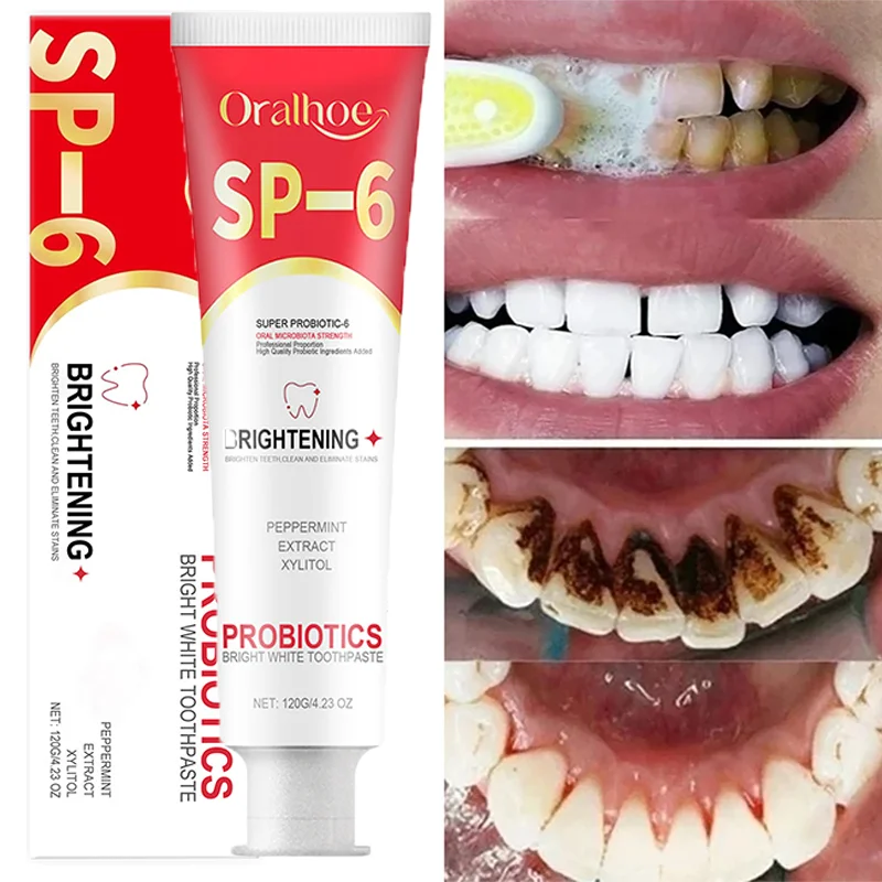 SP-6 Probiotic Toothpaste Whiten Clean Teeth Remove Stains Oral Care Management 