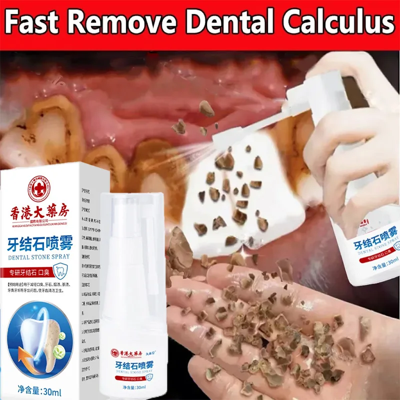 50ML Dental Calculus Remover Teeth Whitening Spray Fresh Breath Care Toothpaste 
