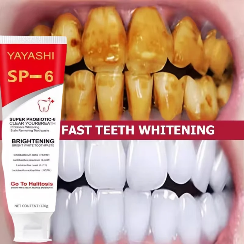 120g Probiotic Toothpaste Teeth Whitening Enzyme Remove Plaque Stains Oral Hygie