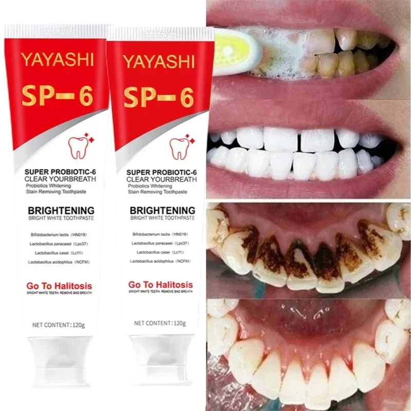 Probiotic Toothpaste Teeth Whitening Enzyme Remove Plaque Stains Oral Hygiene Cl