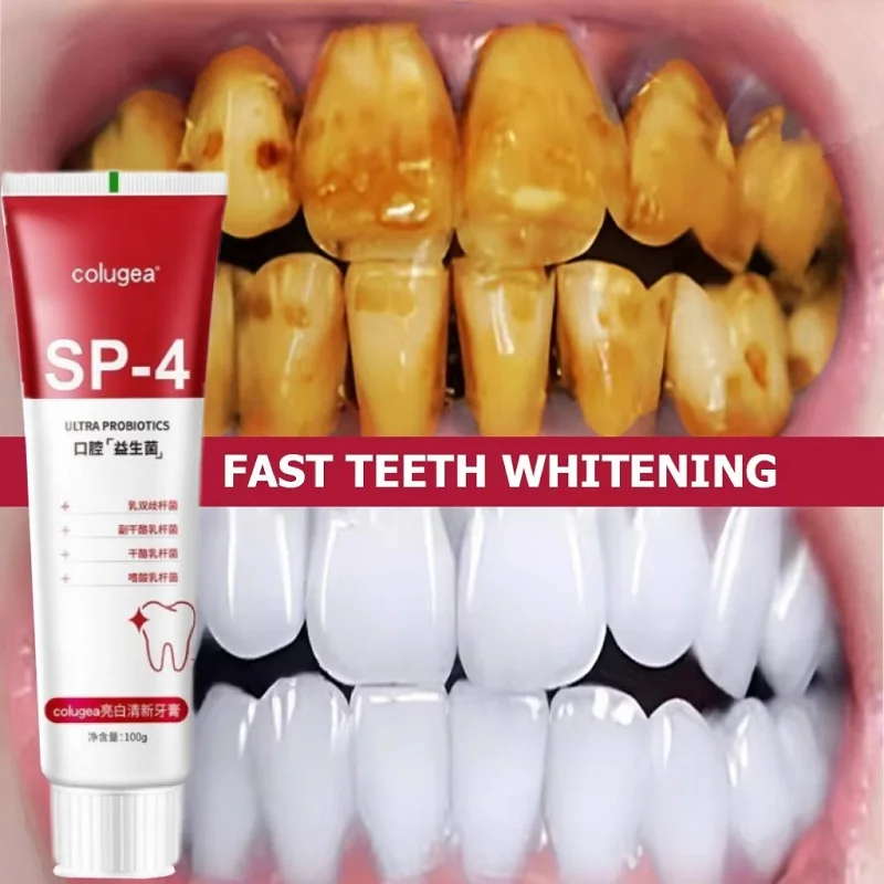 100g Probiotic Toothpaste SP-4 Whitening Tooth Remove Plaque Stains Teeth Whiten