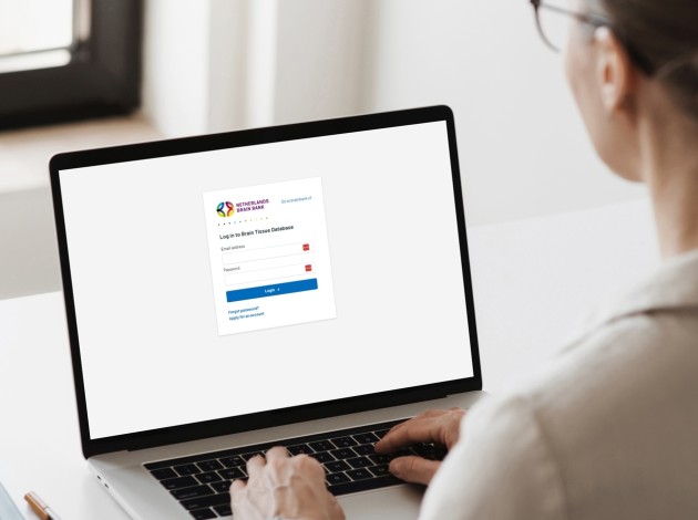 A laptop with the web application for the Nederlandse Hersenbank