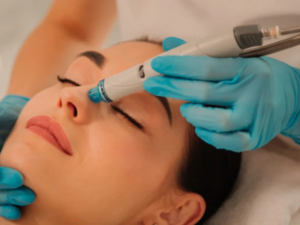 Dermapen 4 + PRP + HYDRAFACIAL