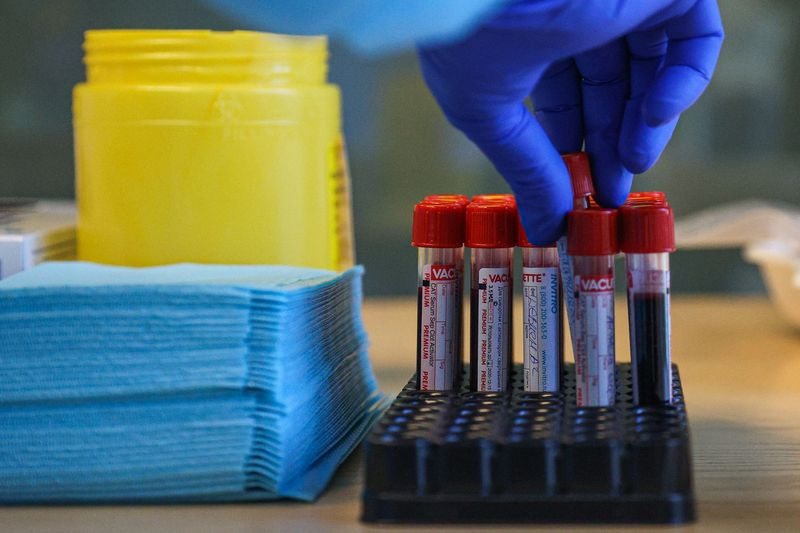 Женщина делает зарядку на фоне цветущих деревьев весной