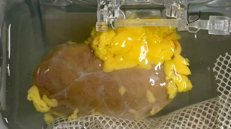 Изображение искусственно созданной почки, готовой к трансплантации