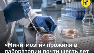 Изображение мини-мозгов в банке, символизирующее празднование шестого дня рождения нейронов Гарварда.