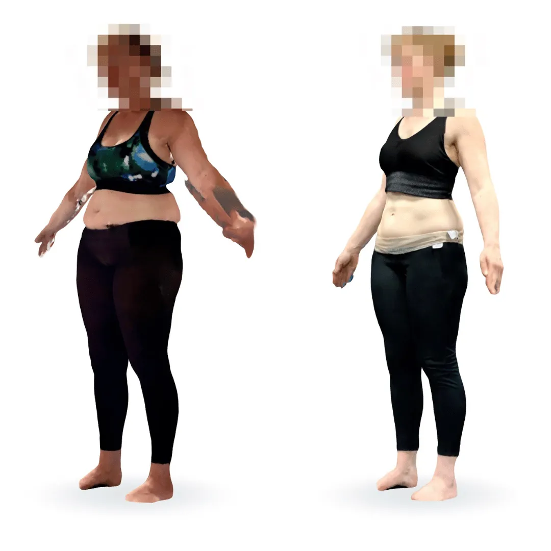 Körpertransformation durch Personal Training in Eggenfelden
