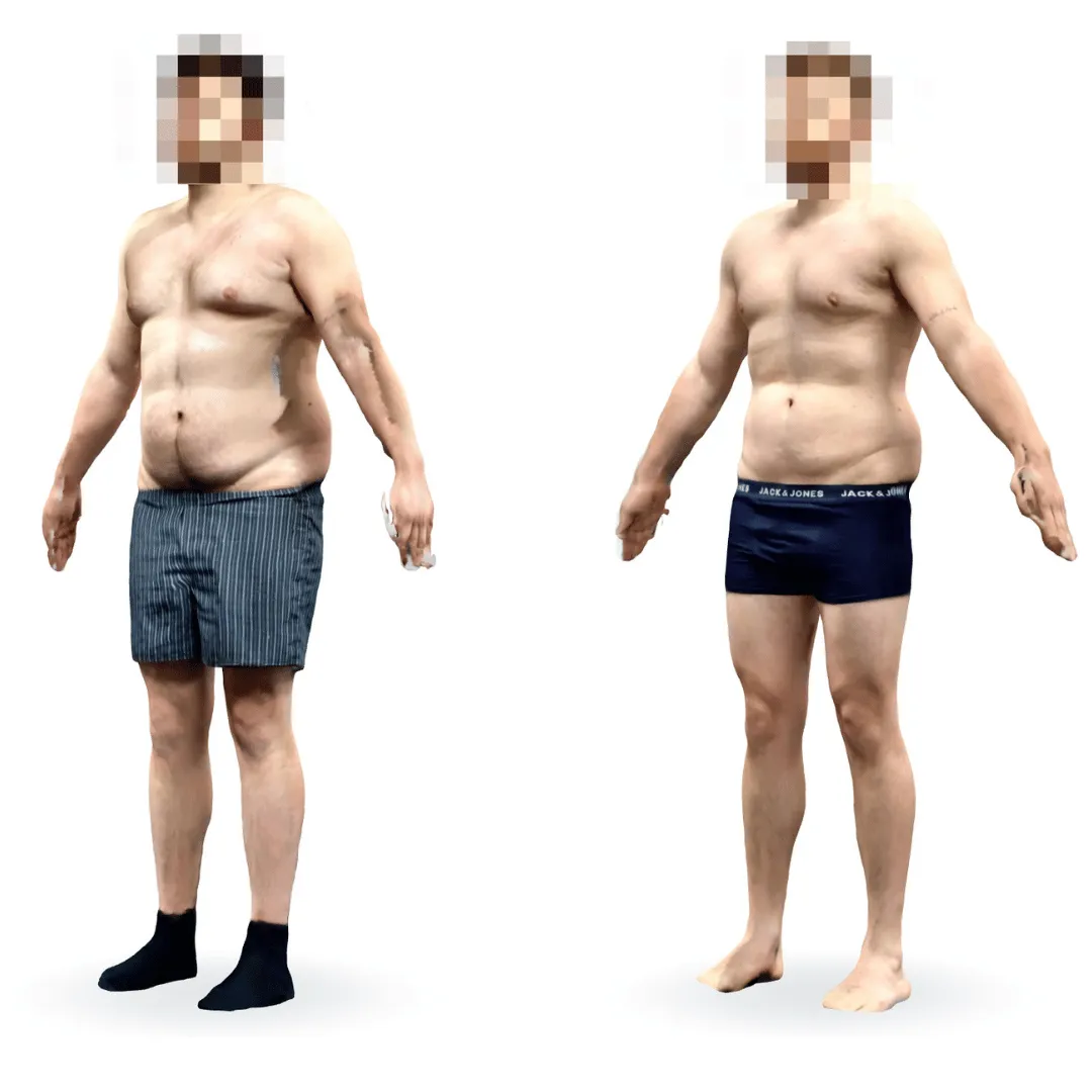 Vorher-Nachher Ergebnis Personal Training Eggenfelden