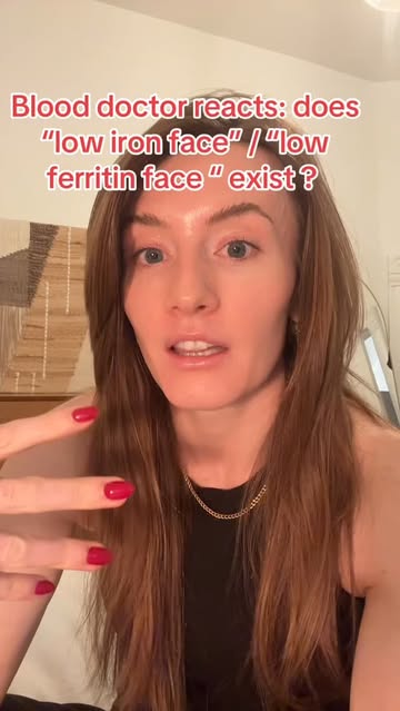Instagram Reel by @dr.victoriavmd, published Apr 29, 2026. Blood doctor reacts: is low iron face a real thing? In my experience- yes! Iron is important in so m…
