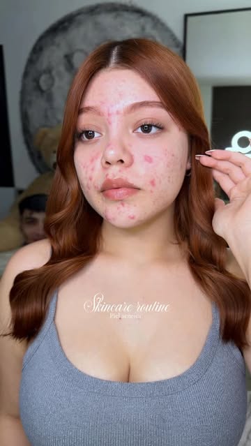 Instagram Reel by @nicoleeromaan, published May 29, 2026. Mi rutina de mañana favorita!! / #acne #skincare #acneskincare #rutina #rutinaskincare